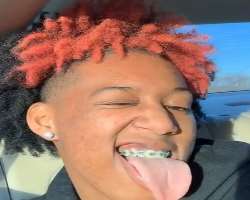 She wears braces to correct her teeth.